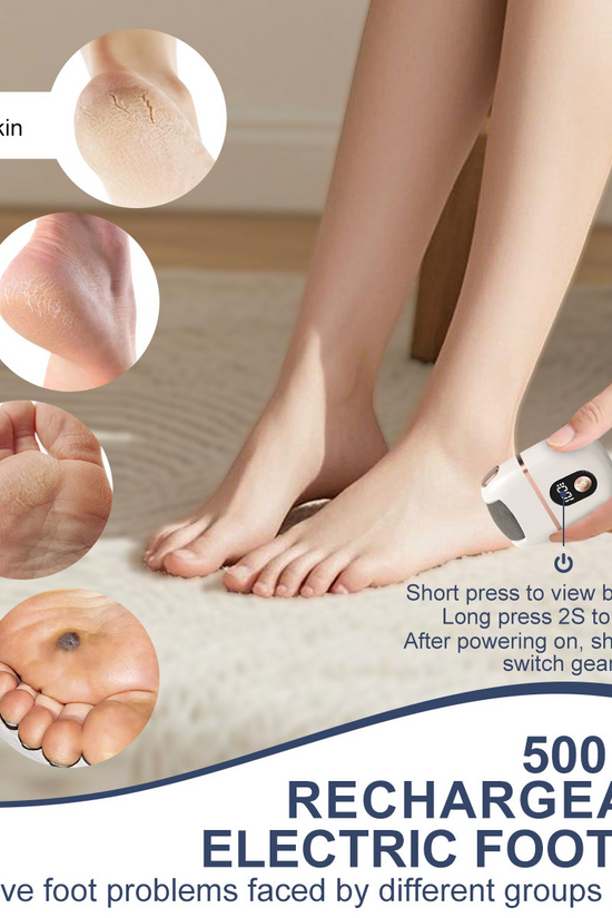 Vacuum Callus Remover – Electric Foot Care Tool