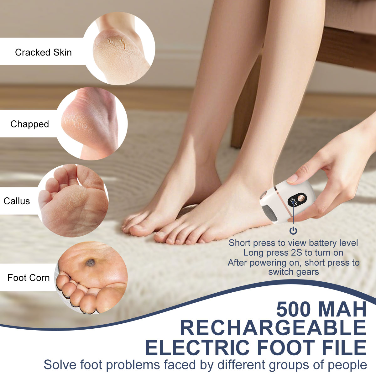 Vacuum Callus Remover – Electric Foot Care Tool